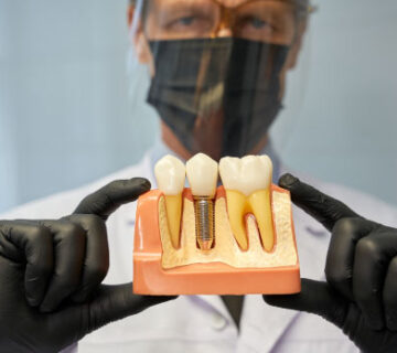 زراعة اسنان