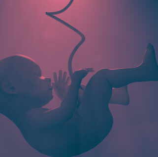 فقدان الحمل المتكرر