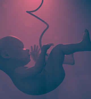 فقدان الحمل المتكرر